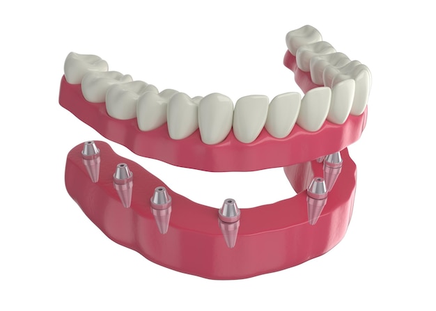 protesis dental toficare 1